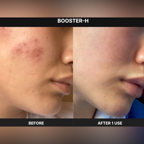 MEDICUBE AGE-R BOOSTER-H K-BEAUTY No.1  Glow Booster - Picture 7 of 9